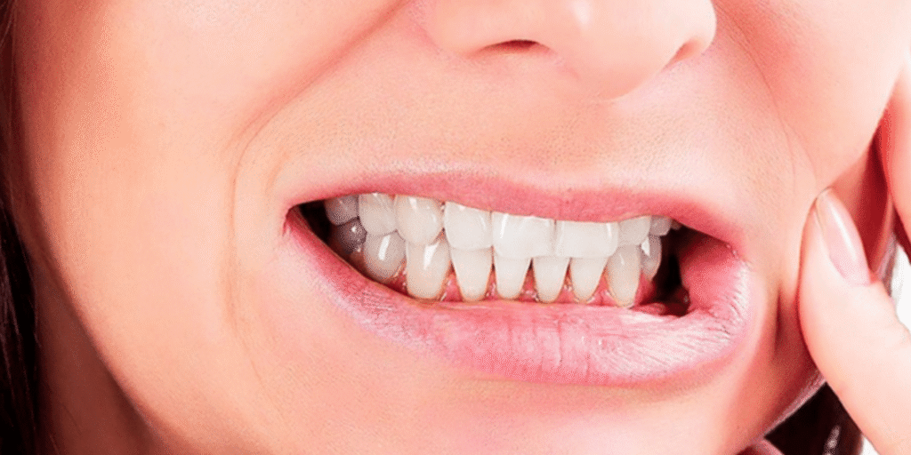 Teeth Grinding