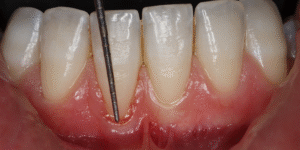 What is Periodontics