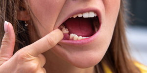 emergency dental implants