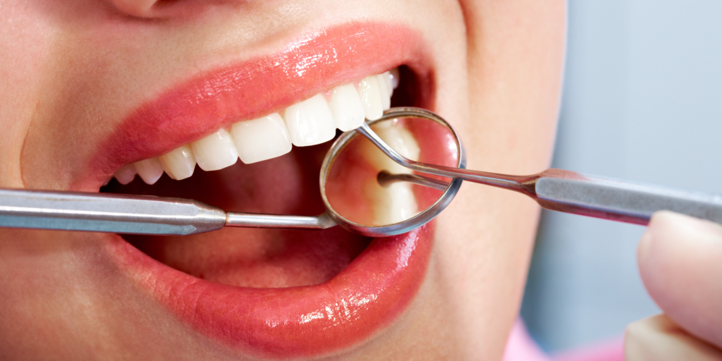 Regular Dental Checkups