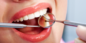 Regular Dental Checkups