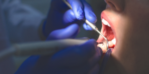 Dentist near me in Ventura
