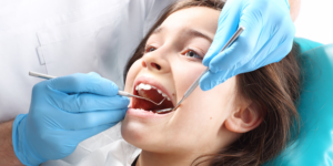 Dental Sealants for Kids and Adults