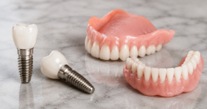 Dental Implants and Dentures Cost