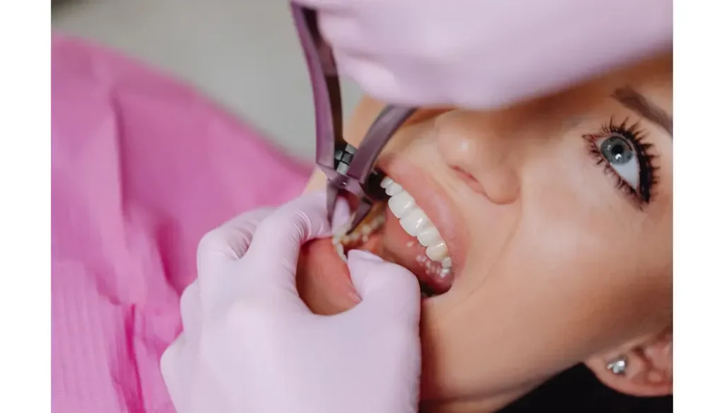 Dentist using dental forceps to extract a tooth while a patient receives dental treatment.